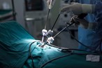 Minimalinvasive chirurgische Instrumente