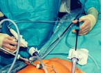Chirurgische Werkzeuge zum Ultraschallverschließen und Trennen